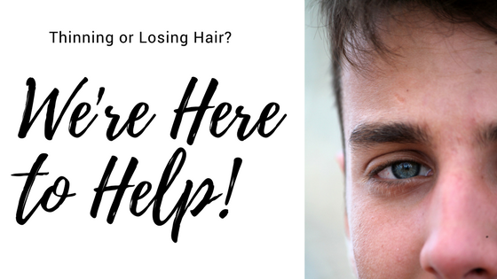 We're here to help with hair loss